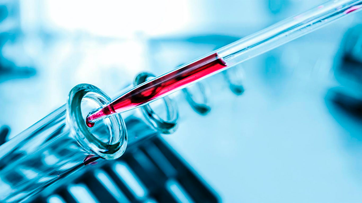 Pruebas de Laboratorio en Cancun