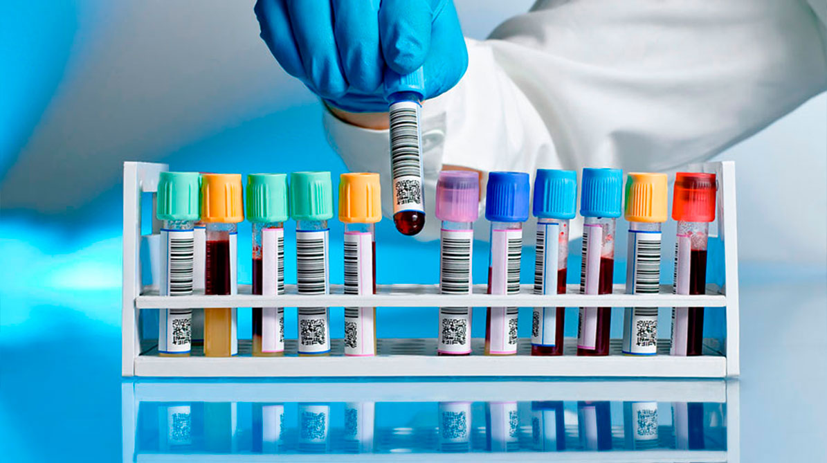 Muestras de Analisis Clinicos en Cancun